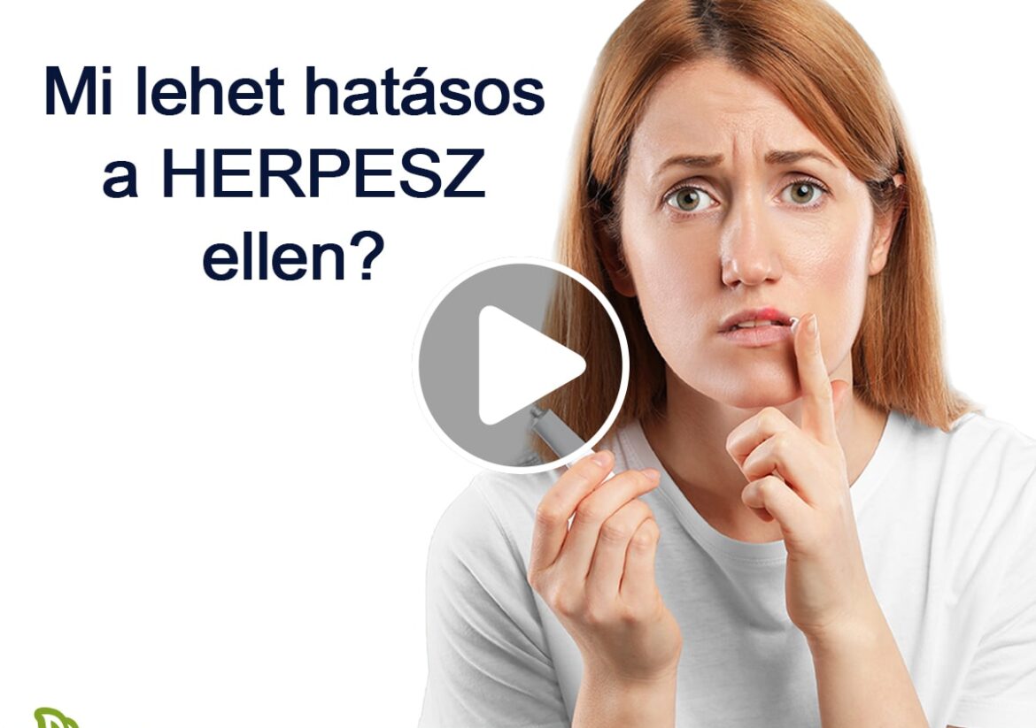 Tudtad, hogy a herpesz megelőzhető?